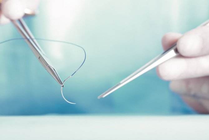 Dewiswch y Standard Of Suture Line